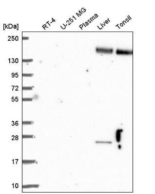 Western Blot: Nidogen-2 Antibody [NBP2-55427]