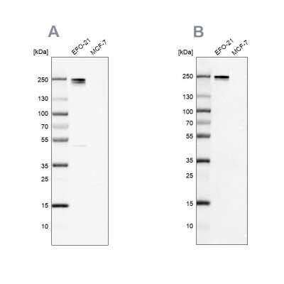 Western Blot: Nidogen-2 Antibody [NBP2-55427]