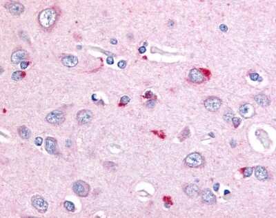 Immunohistochemistry-Paraffin: Niemann-Pick C1 Antibody - BSA Free [NB400-148]