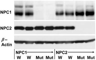 Western Blot: Niemann-Pick C1 AntibodyBSA Free [NB400-148]