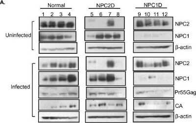 Western Blot: Niemann-Pick C1 AntibodyBSA Free [NB400-148]