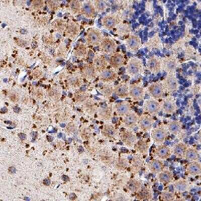 Immunohistochemistry-Paraffin: Niemann-Pick C1 Antibody (1318A) - Azide and BSA Free [NBP2-80879]