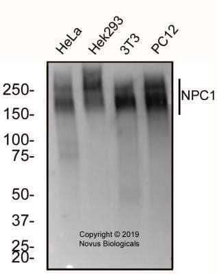 Western Blot: Niemann-Pick C1 Antibody (1318A)Azide and BSA Free [NBP2-80879]