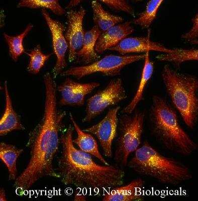 Immunocytochemistry/ Immunofluorescence: Niemann-Pick C1 Antibody (1318A) - BSA Free [NBP2-76798]