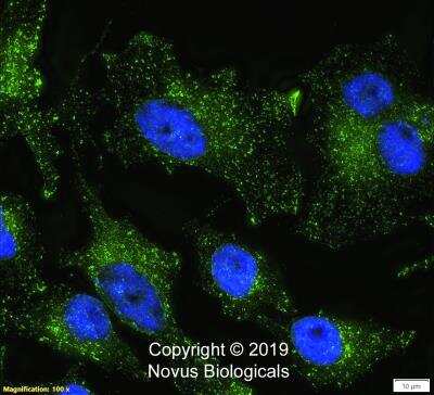 Immunocytochemistry/ Immunofluorescence: Niemann-Pick C1 Antibody (1318A) - BSA Free [NBP2-76798]