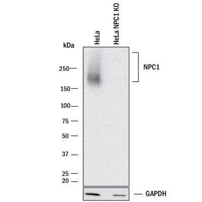 Knockout Validated: Niemann-Pick C1 Antibody (1318A) - BSA Free [NBP2-76798]