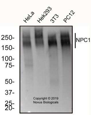 Western Blot: Niemann-Pick C1 Antibody (1318A)BSA Free [NBP2-76798]