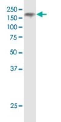 Western Blot: Niemann-Pick C1 Antibody (4H2) [H00004864-M02]