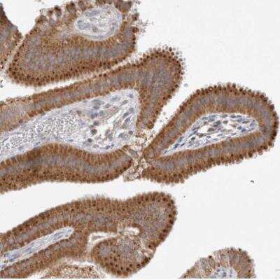 Immunohistochemistry-Paraffin: Niemann-Pick C1 Antibody [NBP2-54678]