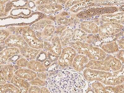 Immunohistochemistry-Paraffin: Niemann-Pick C1 Antibody [NBP2-97133]