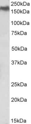 Western Blot: Niemann-Pick C1 Antibody [NBP2-26214]