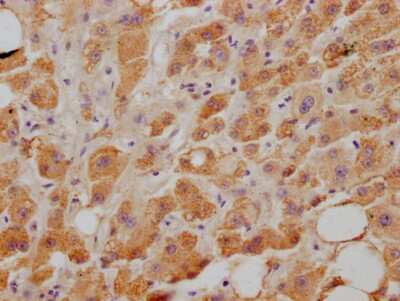 Immunohistochemistry: Niemann-Pick type C1 Like-1 Antibody (4B10) [NBP3-15211]