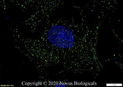 Immunocytochemistry/ Immunofluorescence: Niemann-Pick type C1 Like-1 Antibody [NB400-127]