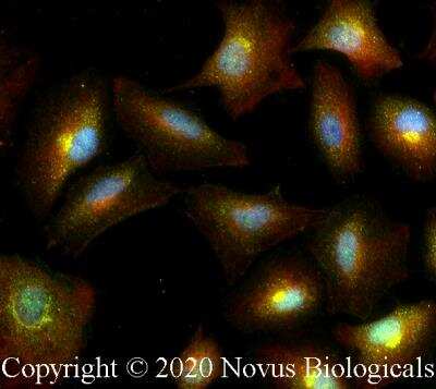 Immunocytochemistry/ Immunofluorescence: Niemann-Pick type C1 Like-1 Antibody - BSA Free [NBP2-89182]