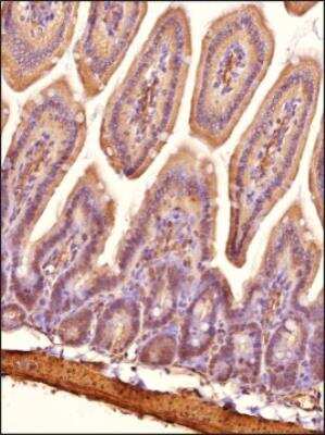 Immunohistochemistry-Paraffin: Niemann-Pick type C1 Like-1 Antibody [NB400-127]