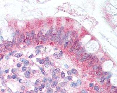 Immunohistochemistry-Paraffin: Niemann-Pick type C1 Like-1 Antibody - BSA Free [NB400-128]