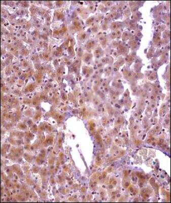 Immunohistochemistry-Paraffin: Niemann-Pick type C1 Like-1 Antibody - BSA Free [NBP2-89182]