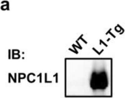 Western Blot: Niemann-Pick type C1 Like-1 AntibodyBSA Free [NB400-128]