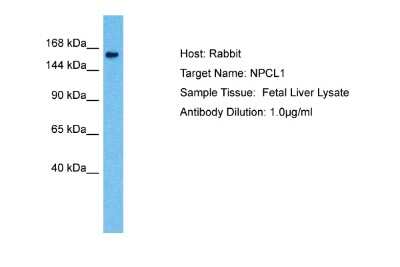 Western Blot: Niemann-Pick type C1 Like-1 Antibody [NBP2-86732]