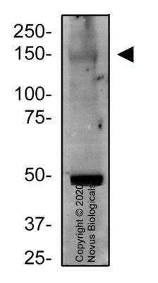 Western Blot: Niemann-Pick type C1 Like-1 AntibodyBSA Free [NBP2-89182]