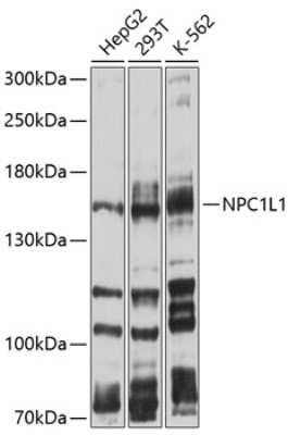 Western Blot: Niemann-Pick type C1 Like-1 AntibodyBSA Free [NBP2-94542]