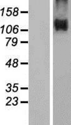 Western Blot: Niemann-Pick type C1 Like-1 Overexpression Lysate [NBP2-10341]