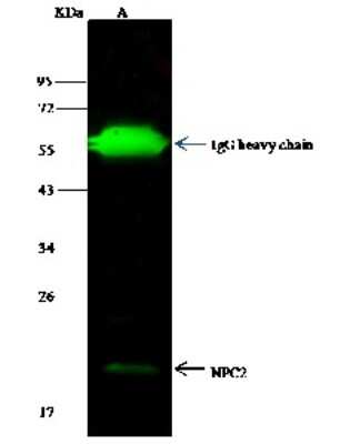 Immunoprecipitation: Niemann-Pick type C2 Antibody (012) [NBP2-90209]