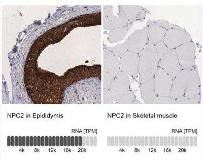 Immunohistochemistry-Paraffin: Niemann-Pick type C2 Antibody [NBP1-84012]