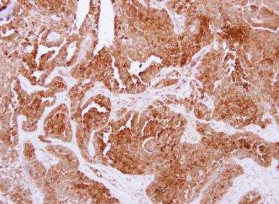 Immunohistochemistry-Paraffin: Niemann-Pick type C2 Antibody [NBP2-15044]