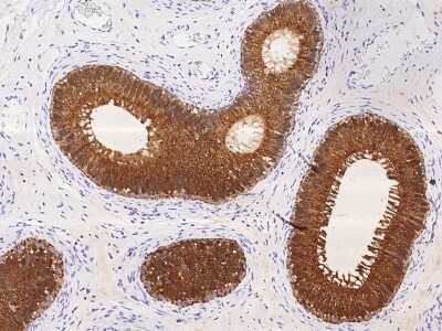 Immunohistochemistry-Paraffin: Niemann-Pick type C2 Antibody [NBP2-99920]