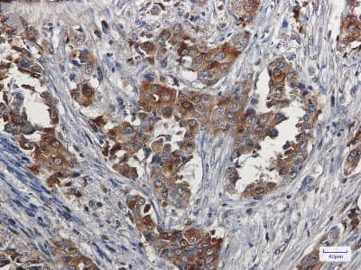 Immunohistochemistry-Paraffin: Niemann-Pick type C2 Antibody (S09-8D3) [NBP3-14872]