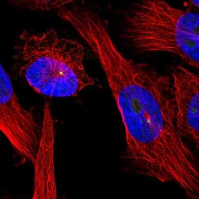 Immunocytochemistry/ Immunofluorescence: Ninein Antibody [NBP2-13657]