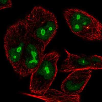 Immunocytochemistry/ Immunofluorescence: Ninein Antibody [NBP2-57419]