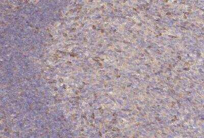 Immunohistochemistry-Paraffin: Ninein Antibody [NBP2-13657]