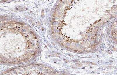 Immunohistochemistry-Paraffin: Ninein Antibody [NBP2-13657]