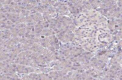 Immunohistochemistry-Paraffin: Ninein Antibody [NBP2-13657]