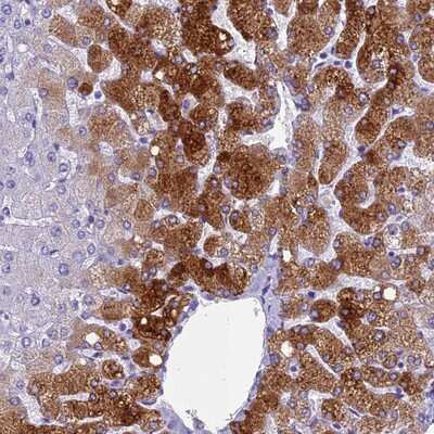 Immunohistochemistry-Paraffin: Ninjurin-1 Antibody [NBP1-92181]