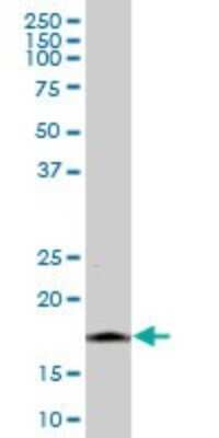 Western Blot: Ninjurin-1 Antibody [H00004814-B01P]