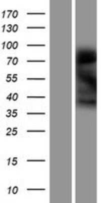 Western Blot: Ninjurin-1 Overexpression Lysate [NBP2-10569]