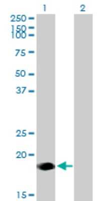 Western Blot: Ninjurin-2 Antibody [H00004815-B02P]