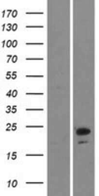 Western Blot: Ninjurin-2 Overexpression Lysate [NBP2-07023]