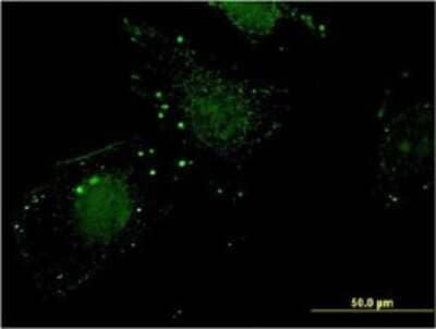 Immunocytochemistry/ Immunofluorescence: Nitrilase 1 Antibody (1C3) [H00004817-M01]