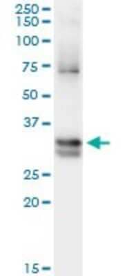 Immunoprecipitation: Nitrilase 1 Antibody (1C3) [H00004817-M01]