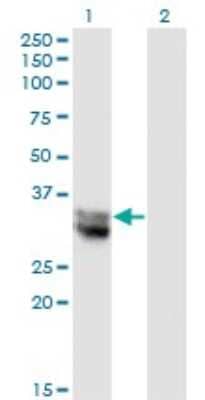 Western Blot: Nitrilase 1 Antibody (1C3) [H00004817-M01]