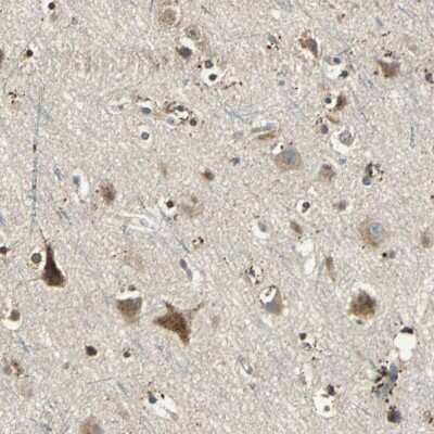 Immunohistochemistry-Paraffin: Nitrilase 1 Antibody [NBP1-87481]