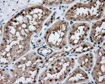 Immunohistochemistry: Nitrilase 1 Antibody (OTI3A11) - Azide and BSA Free [NBP2-72999]