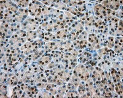 Immunohistochemistry: Nitrilase 1 Antibody (OTI3A11) - Azide and BSA Free [NBP2-72999]