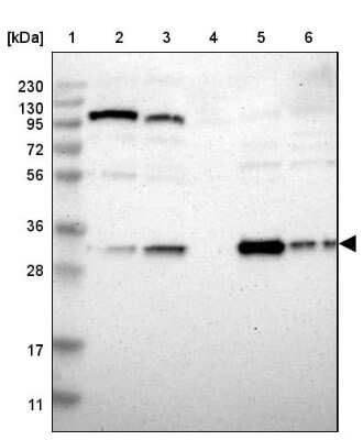 Western Blot: Nitrilase 1 Antibody [NBP1-87481]