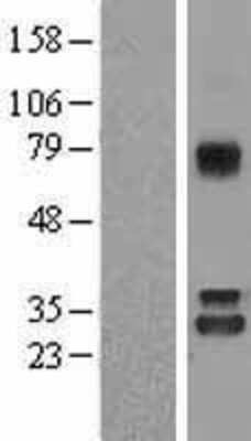 Western Blot: Nitrilase 1 Overexpression Lysate [NBL1-13648]