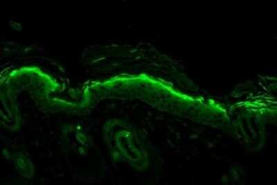 Immunohistochemistry: Nitrotyrosine Antibody (39B6) [NB110-96877]